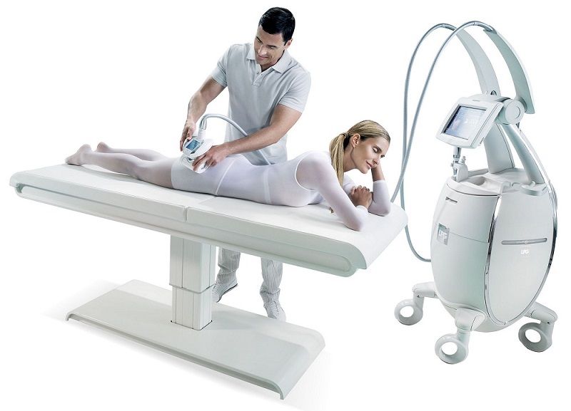 TESTAREA NOULUI APARAT LPG ALLIANCE DE CATRE VEDETE SI BLOGGERI