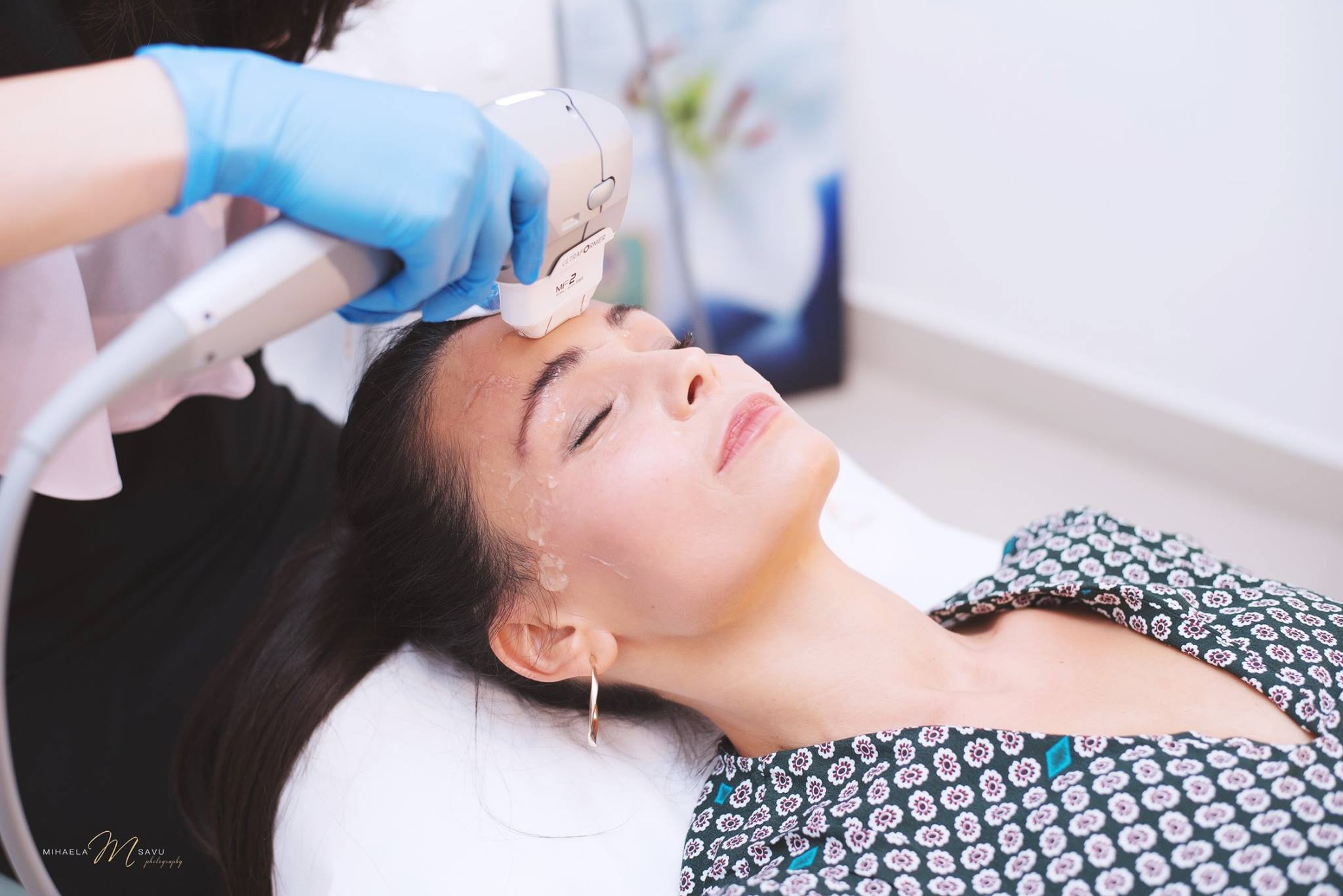 Lansare ULTRAFORMER 3, tehnologia pentru liftingul nechirurgical al zonei ochilor