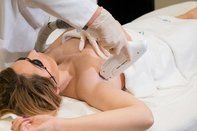 Care este diferenta intre epilarea cu laser si cea IPL?